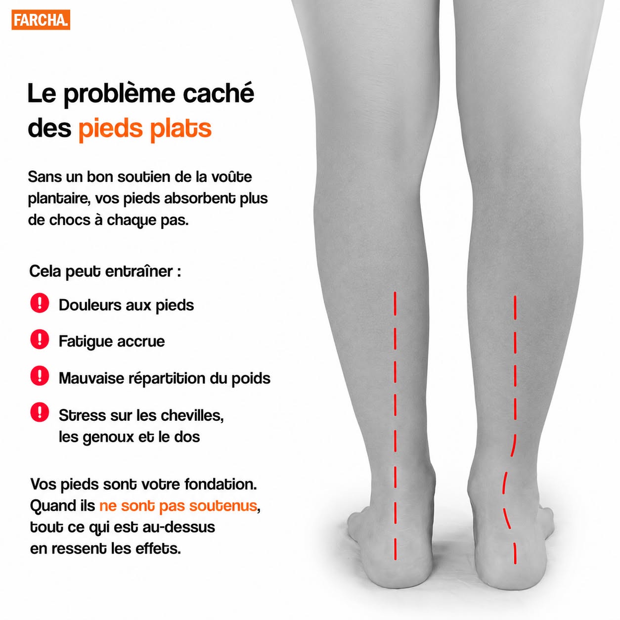 Flat feet problem illustration