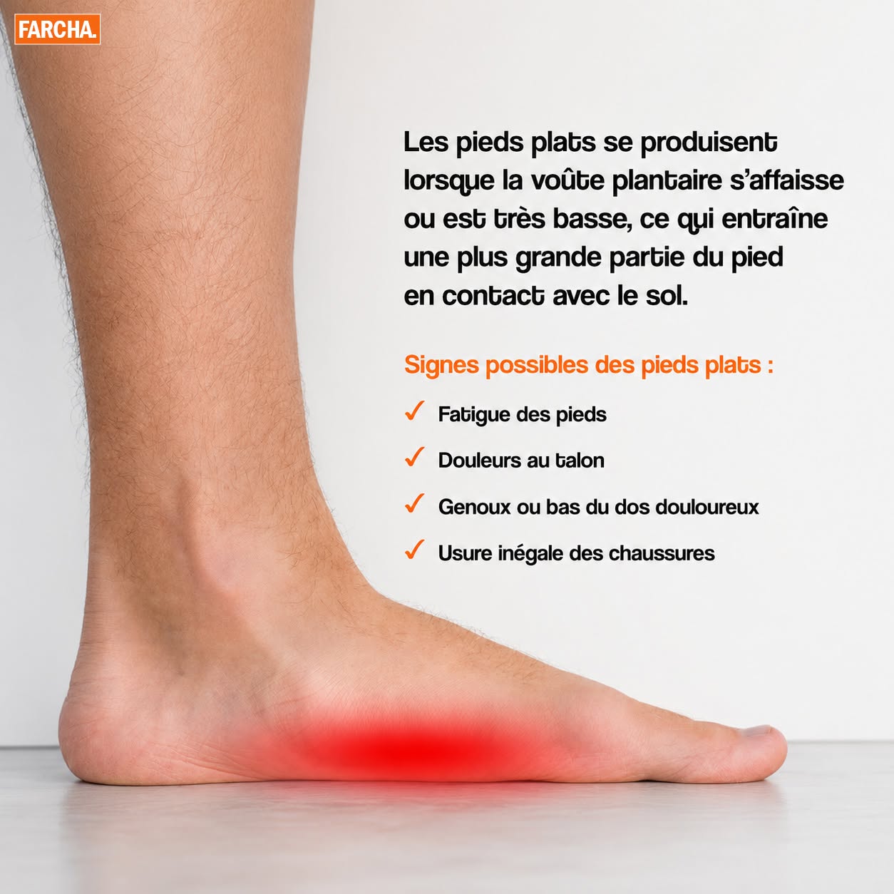Flat feet symptoms