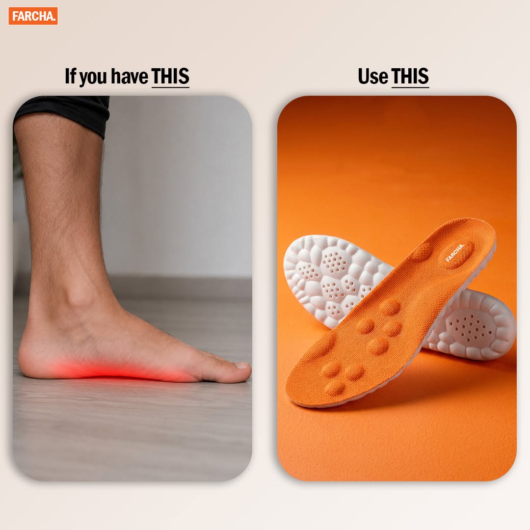 Before and after flat foot